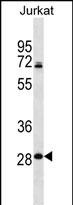 WB - RPL11 Antibody (N-term) AP12353a